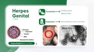 Herpes Simples 2 (Vírus de DNA)
Transmissão
Contato sexual
Tratamento Anti enzimáticos como o aciclovir
Materno fetal
 