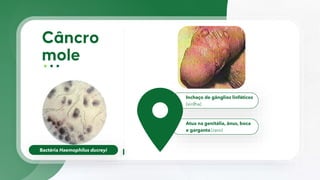 Bactéria Haemophilus ducreyi
Inchaço de gânglios linfáticos
(virilha)
Atua na genitália, ânus, boca
e garganta (raro)
 