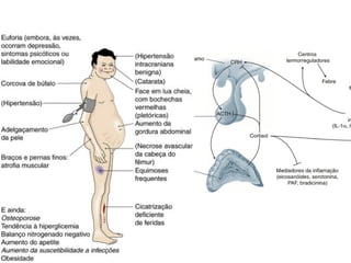Aula - Anti-inflamatórios esteróidais