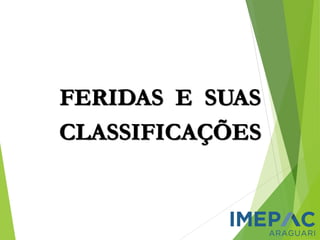 FERIDAS E SUAS
CLASSIFICAÇÕES
 