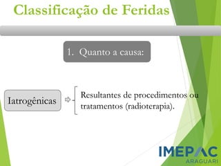 Classificação de Feridas
1. Quanto a causa:
Iatrogênicas
Resultantes de procedimentos ou
tratamentos (radioterapia).
 