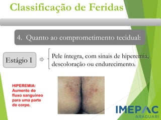 Classificação de Feridas
4. Quanto ao comprometimento tecidual:
Estágio I
Pele íntegra, com sinais de hiperemia,
descoloração ou endurecimento.
HIPEREMIA:
Aumento do
fluxo sanguíneo
para uma parte
do corpo.
 