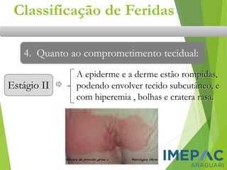 Estágio II
Classificação de Feridas
4. Quanto ao comprometimento tecidual:
A epiderme e a derme estão rompidas,
podendo envolver tecido subcutâneo, e
com hiperemia , bolhas e cratera rasa.
 