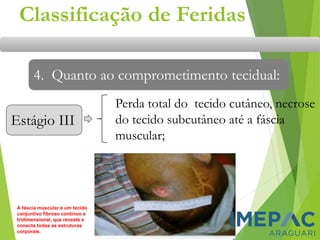 Estágio III
Classificação de Feridas
4. Quanto ao comprometimento tecidual:
Perda total do tecido cutâneo, necrose
do tecido subcutâneo até a fáscia
muscular;
A fáscia muscular é um tecido
conjuntivo fibroso contínuo e
tridimensional, que reveste e
conecta todas as estruturas
corporais.
 