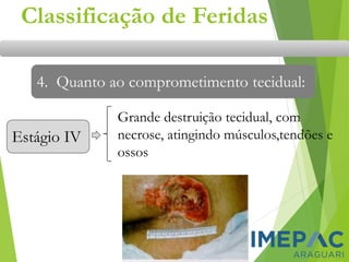 Estágio IV
Classificação de Feridas
4. Quanto ao comprometimento tecidual:
Grande destruição tecidual, com
necrose, atingindo músculos,tendões e
ossos
 