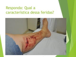 Responda: Qual a
característica dessa feridas?
 