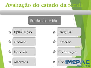 Avaliação do estado da ferida
Bordas da ferida
Epitalização
Macerada
Necrose
Isquemia
Irregular
Contaminação
Infecção
Colonização
 