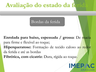 Enrolada para baixo, espessada / grossa: De macia
para firme e flexível ao toque;
Hiperqueratose: Formação de tecido caloso ao redor
da ferida e até as bordas
Fibrótica, com cicatriz: Dura, rígida ao toque.
Avaliação do estado da ferida
Bordas da ferida
 