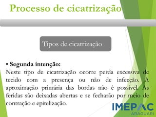 • Segunda intenção:
Neste tipo de cicatrização ocorre perda excessiva de
tecido com a presença ou não de infecção. A
aproximação primária das bordas não é possível. As
feridas são deixadas abertas e se fecharão por meio de
contração e epitelização.
Tipos de cicatrização
Processo de cicatrização
 