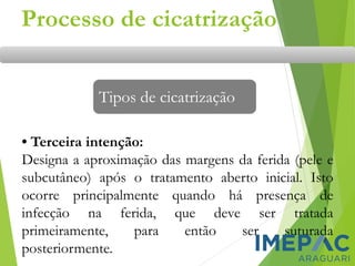 • Terceira intenção:
Designa a aproximação das margens da ferida (pele e
subcutâneo) após o tratamento aberto inicial. Isto
ocorre principalmente quando há presença de
infecção na ferida, que deve ser tratada
primeiramente, para então ser suturada
posteriormente.
Tipos de cicatrização
Processo de cicatrização
 