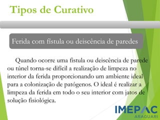 Tipos de Curativo
Ferida com fístula ou deiscência de paredes
Quando ocorre uma fistula ou deiscência de parede
ou túnel torna-se difícil a realização de limpeza no
interior da ferida proporcionando um ambiente ideal
para a colonização de patógenos. O ideal é realizar a
limpeza da ferida em todo o seu interior com jatos de
solução fisiológica.
 