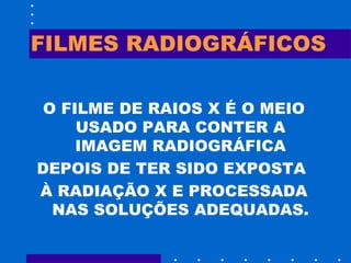 Aula filmes radiográficos | PPT