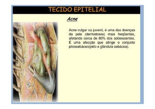 Aula.histo.teg