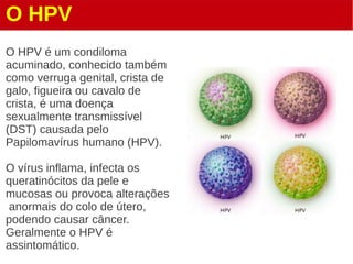 O HPV
O HPV é um condiloma
acuminado, conhecido também
como verruga genital, crista de
galo, figueira ou cavalo de
crista, é uma doença
sexualmente transmissível
(DST) causada pelo
Papilomavírus humano (HPV).
O vírus inflama, infecta os
queratinócitos da pele e
mucosas ou provoca alterações
anormais do colo de útero,
podendo causar câncer.
Geralmente o HPV é
assintomático.
 