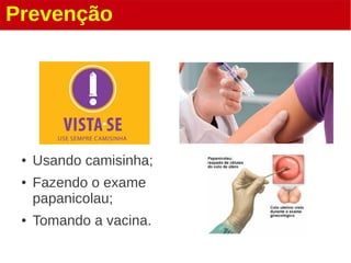 Prevenção
● Usando camisinha;
● Fazendo o exame
papanicolau;
● Tomando a vacina.
 