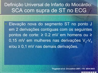 Definição Universal de Infarto do Miocárdio:   SCA com supra de ST no ECG Elevação nova do segmento ST no ponto J em 2 derivações contíguas com os seguintes pontos de corte:  ≥ 0.2 mV em homens ou ≥ 0,15 mV em mulheres nas derivações V 2 -V 3  e/ou ≥ 0,1 mV nas demais derivações. Thygesen et al. Circulation 2007; 116: 2634-2653 