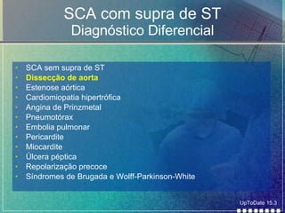 SCA com supra de ST Diagnóstico Diferencial SCA sem supra de ST  Dissecção de aorta Estenose aórtica Cardiomiopatia hipertrófica Angina de Prinzmetal Pneumotórax Embolia pulmonar Pericardite Miocardite Úlcera péptica Repolarização precoce Síndromes de Brugada e Wolff-Parkinson-White UpToDate 15.3 