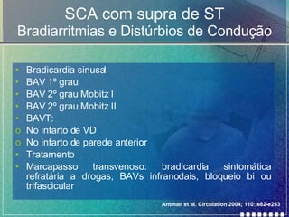 SCA com supra de ST Bradiarritmias e Distúrbios de Condução Bradicardia sinusal BAV 1º grau BAV 2º grau Mobitz I BAV 2º grau Mobitz II BAVT: No infarto de VD No infarto de parede anterior Tratamento Marcapasso transvenoso: bradicardia sintomática refratária a drogas, BAVs infranodais, bloqueio bi ou trifascicular  Antman et al. Circulation 2004; 110: e82-e293 