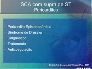 SCA com supra de ST Pericardites Pericardite Epistenocárdica Síndrome de Dressler Diagnóstico Tratamento Anticoagulação Martins et al. Emergências Clínicas; 3ª ed.; 2007 