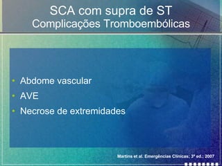 Abdome vascular AVE Necrose de extremidades SCA com supra de ST Complicações Tromboembólicas Martins et al. Emergências Clínicas; 3ª ed.; 2007 
