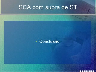 SCA com supra de ST Conclusão 