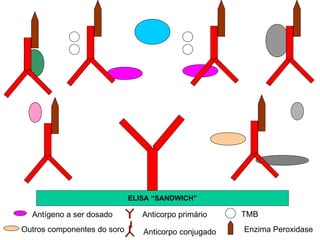 Outros componentes do soro ELISA “SANDWICH” Antígeno a ser dosado Anticorpo primário Anticorpo conjugado TMB Enzima Peroxidase 