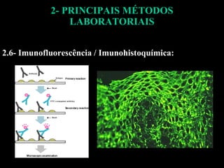 2- PRINCIPAIS MÉTODOS LABORATORIAIS 2.6- Imunofluorescência / Imunohistoquímica: 