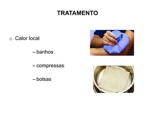 TRATAMENTO
o Calor local
– banhos
– compressas
– bolsas
 