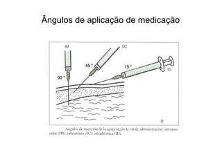 Ângulos de aplicação de medicação
 