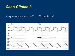 Caso Clínico 3 O que mostra a curva?  O que fazer? 