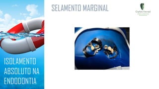 SELAMENTO MARGINAL
ISOLAMENTO
ABSOLUTO NA
ENDODONTIA
 
