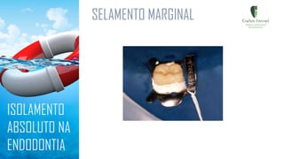 SELAMENTO MARGINAL
ISOLAMENTO
ABSOLUTO NA
ENDODONTIA
 