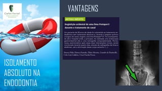 VANTAGENS
ISOLAMENTO
ABSOLUTO NA
ENDODONTIA
 