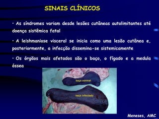 SINAIS CLÍNICOS

• As síndromes variam desde lesões cutâneas autolimitantes até
doença sistêmica fatal

• A leishmaniose visceral se inicia como uma lesão cutânea e,
posteriormente, a infecção dissemina-se sistemicamente

• Os órgãos mais afetados são o baço, o fígado e a medula
óssea




                                                   Meneses, AMC
 