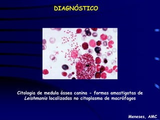 DIAGNÓSTICO




Citologia de medula óssea canina - formas amastigotas de
   Leishmania localizadas no citoplasma de macrófagos


                                                 Meneses, AMC
 
