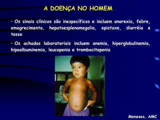 A DOENÇA NO HOMEM

• Os sinais clínicos são inespecíficos e incluem anorexia, febre,
emagrecimento, hepatoesplenomegalia, epistaxe, diarréia e
tosse

• Os achados laboratoriais incluem anemia, hiperglobulinemia,
hipoalbuminemia, leucopenia e trombocitopenia




                                                      Meneses, AMC
 