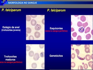 MORFOLOGIA NO SANGUE
 