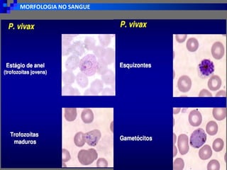 MORFOLOGIA NO SANGUE
 