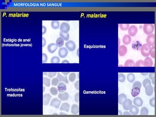 MORFOLOGIA NO SANGUE
 