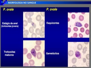 MORFOLOGIA NO SANGUE
 