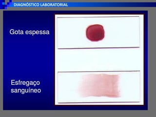 DIAGNÓSTICO LABORATORIAL
 