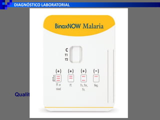 DIAGNÓSTICO LABORATORIAL
Qualitativo
 