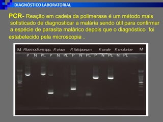 DIAGNÓSTICO LABORATORIAL
PCR- Reação em cadeia da polimerase é um método mais
sofisticado de diagnosticar a malária sendo útil para confirmar
a espécie de parasita malárico depois que o diagnóstico foi
estabelecido pela microscopia .
 