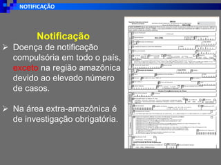 NOTIFICAÇÃO
Notificação
➢ Doença de notificação
compulsória em todo o país,
exceto na região amazônica
devido ao elevado número
de casos.
➢ Na área extra-amazônica é
de investigação obrigatória.
 