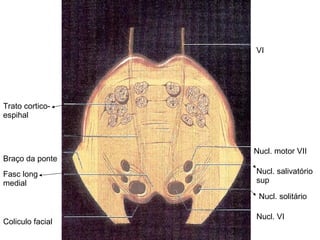 Nucl. solitário Nucl. salivatório sup Nucl. motor VII Nucl. VI Coliculo facial Fasc long medial Trato cortico-espihal Braço da ponte VI 