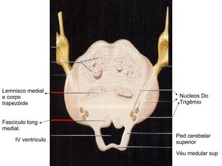 Nucleos Do Trigêmio Lemnisco medial e corpo trapezóide Fasciculo long medial. IV ventriculo Véu medular sup Ped cerebelar superior 