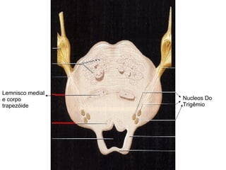 Nucleos Do Trigêmio Lemnisco medial e corpo trapezóide 