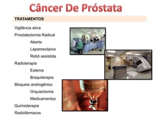 TRATAMENTOS
Vigilância ativa
Prostatectomia Radical
Aberta
Laparoscópica
Robô assistida
Radioterapia
Externa
Braquiterapia
Bloqueio androgênico
Orquiectomia
Medicamentos
Quimioterapia
Radiofármacos
 