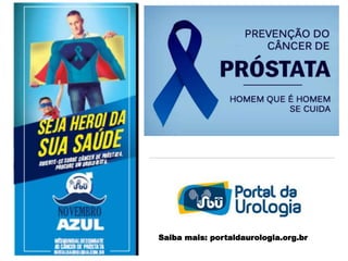 Saiba mais: portaldaurologia.org.br
 