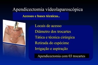 Apendicectomia vídeolaparoscópica  Acessos e bases técnicas.. Apendicectomia com 03 trocartes  Locais de acesso Diâmetro dos trocartes Tática e técnica cirúrgica Retirada do espécime Irrigação e aspiração 